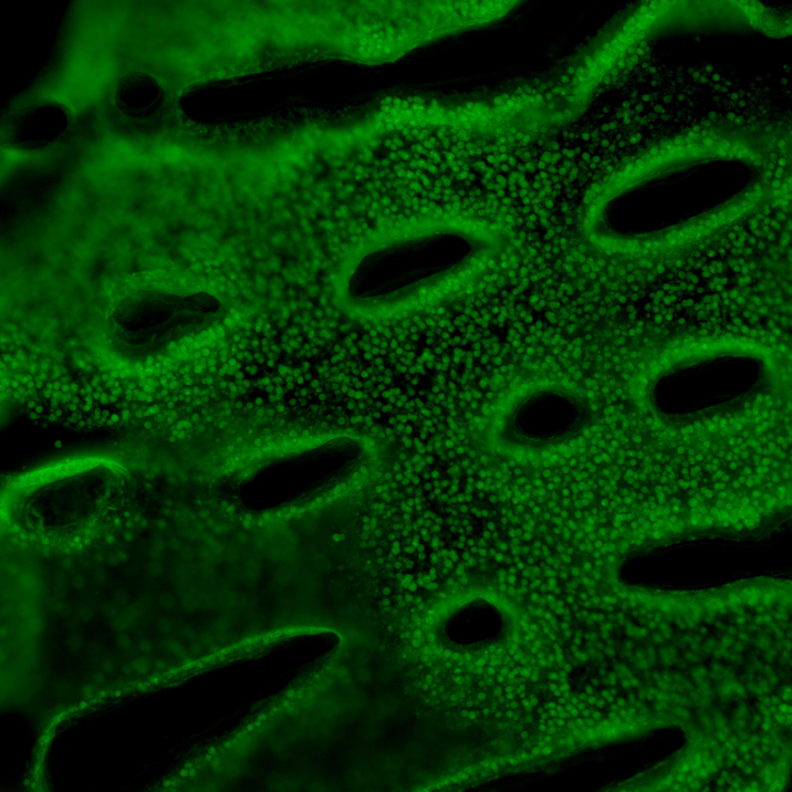 Fluorescently labeled embedded coral core